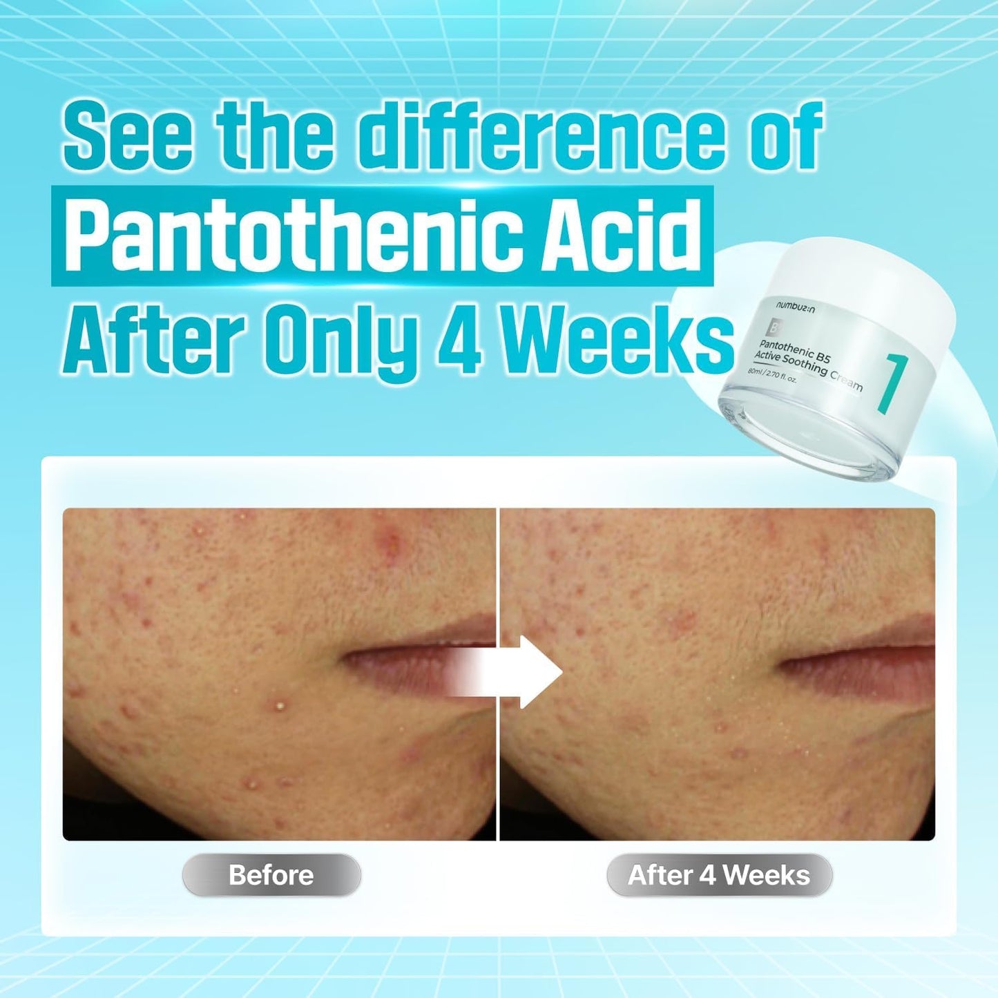 numbuzin No.1 Pantothenic B5 Active Soothing Cream | Lightweight Facial Moisturizer, Excess Oil Control, Pantothenic Acid, Hydrating, Non-Comedogenic | 80ml, 2.70 fl oz