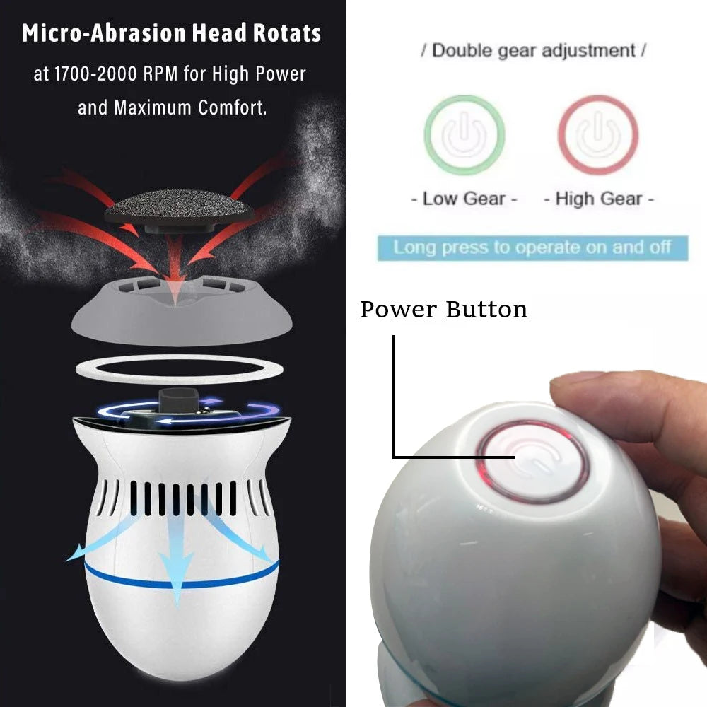 Electric Foot Grinder with Automatic Vacuum USB Rechargeable Two-speed Adjustment and 6 Grinding Heads Callus Dead Skin Removal