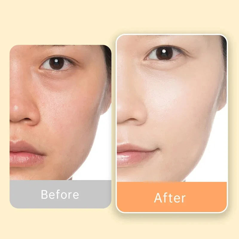 Vitamin C Whitening Facial Cream Dark Spots Remover Face Serum Set Hyaluronic Acid Moisturizing Skin Care Beauty Health