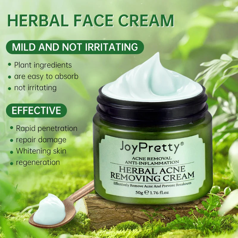 JoyPretty VC Whitening Face Cream Herbal Acne Treatment Set Retinol Anti Wrinkle Combo For Dark Skin Cream Facial Skin Care 50g