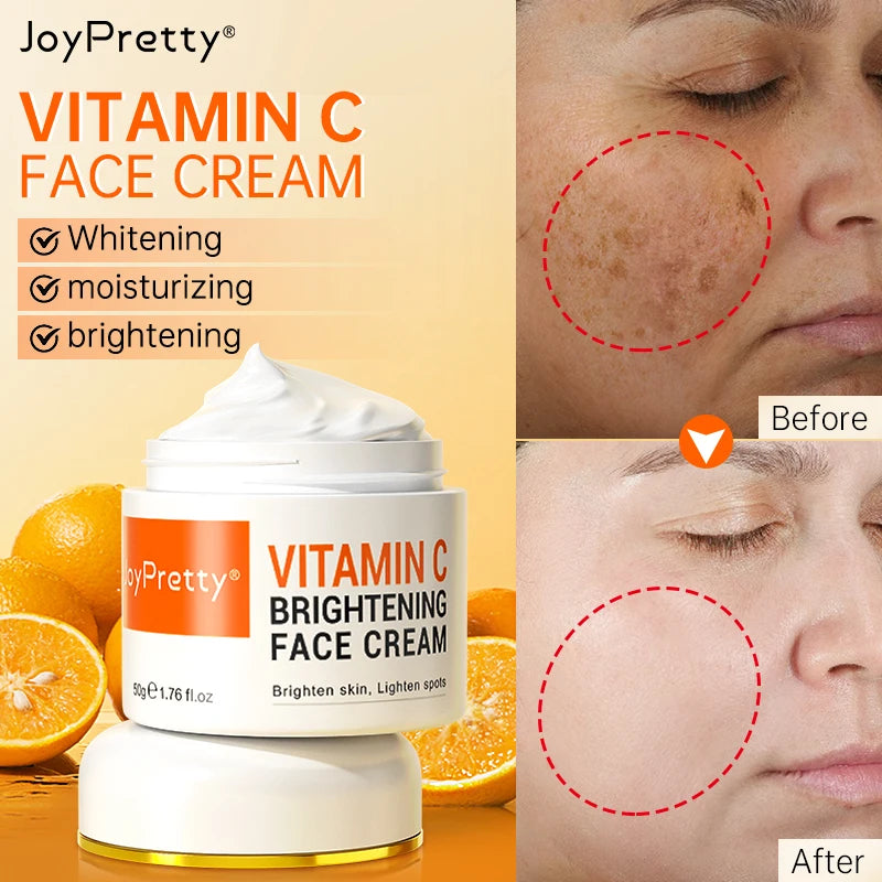 Whitening Face Cream Hyaluronic Acid Vitamin C Lightening Dark Spot Moisturizing Brightening Rejuvenation Cream Facial Skin Care